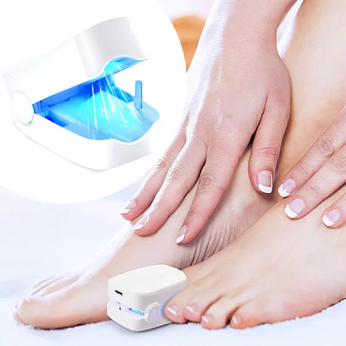 Dispositivo Láser para Limpiar Hongos en Uñas