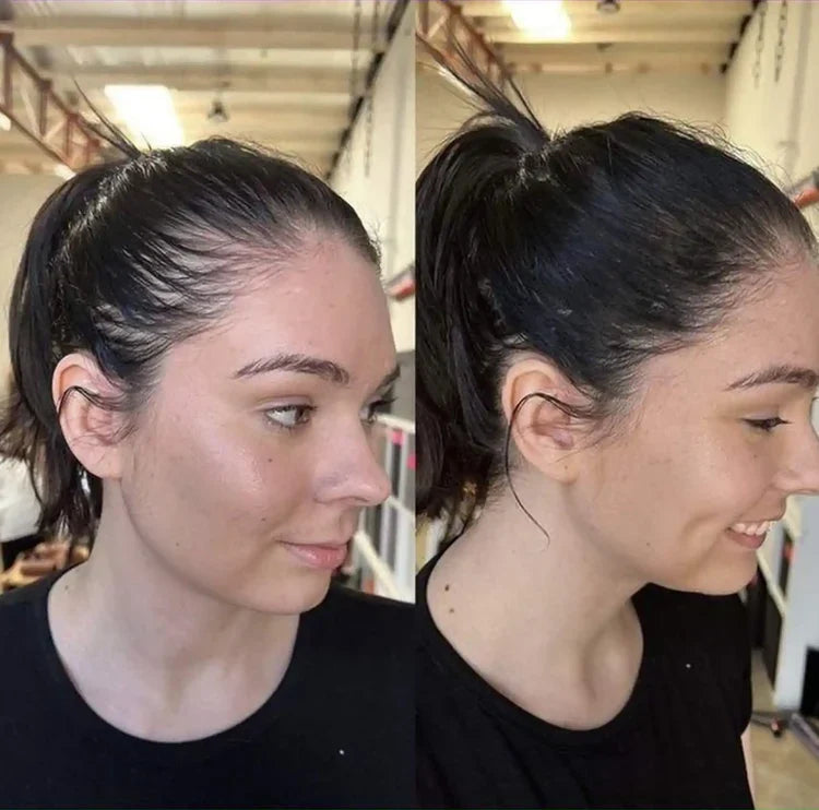 HairGrowth-Sistema de Fortalecimiento Capilar