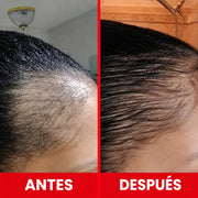 Revivra™ | Cápsulas Restauradoras para el Cabello 2X1
