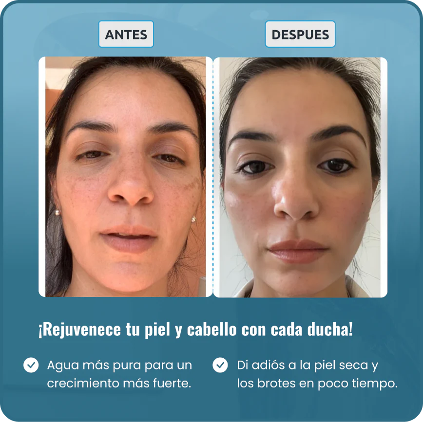 Filtro de ducha Vitaly