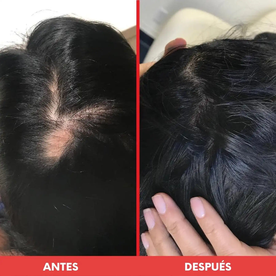 Revivra™ | Cápsulas Restauradoras para el Cabello 2X1