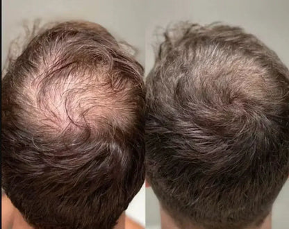 HairGrowth-Sistema de Fortalecimiento Capilar